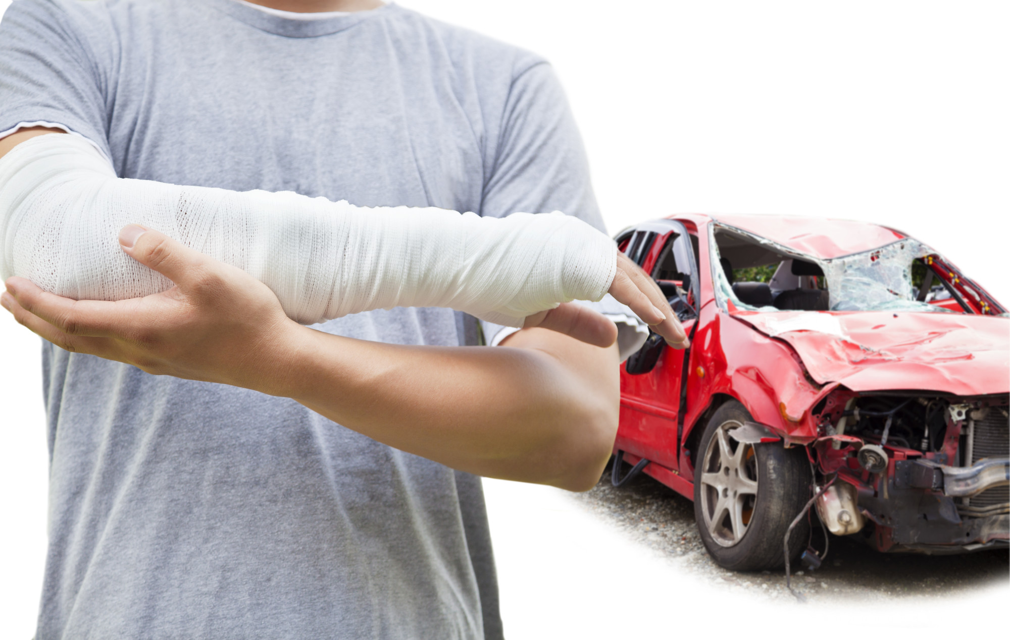 5 Common Car Accident Injuries And What To Do About Them Auto Facts